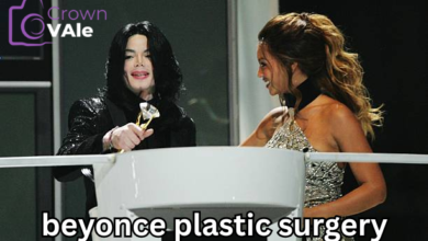 beyonce plastic surgery